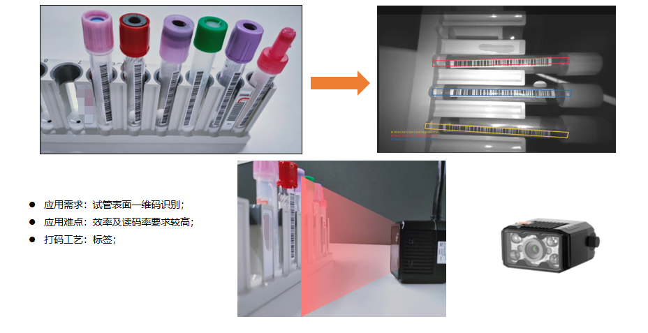 破局试管码识别困境：医疗自动化